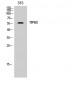 TIP60 Polyclonal Antibody