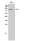 TMC8 Polyclonal Antibody