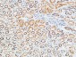 TNF-R1 Polyclonal Antibody