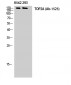 Topo IIα Polyclonal Antibody