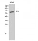 tPA Polyclonal Antibody