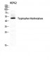 TPH1 Polyclonal Antibody