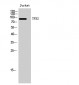 TPX2 Polyclonal Antibody