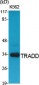 TRADD Polyclonal Antibody