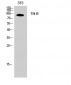 Trk B Polyclonal Antibody