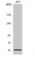 TrxR2 Polyclonal Antibody