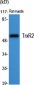 TrxR2 Polyclonal Antibody