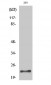 Trypsin-1 Polyclonal Antibody