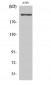 T-type Ca++ CP α1H Polyclonal Antibody