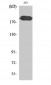 Tuberin Polyclonal Antibody