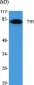 TYR Polyclonal Antibody