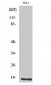 UBE2D2 Polyclonal Antibody