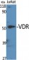 VDR Polyclonal Antibody