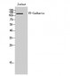 VE-Cadherin Polyclonal Antibody