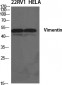 Vimentin Polyclonal Antibody