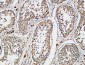 XIAP Polyclonal Antibody