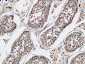 XIAP Polyclonal Antibody