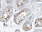 YB-1 Polyclonal Antibody