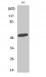 ZAC1 Polyclonal Antibody