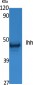 Ihh Polyclonal Antibody