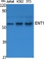 ENT1 Polyclonal Antibody