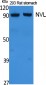 NVL Polyclonal Antibody