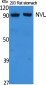 NVL Polyclonal Antibody