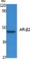 AR-β2 Polyclonal Antibody