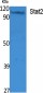 Stat2 Polyclonal Antibody