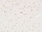 AAT Polyclonal Antibody
