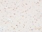 AAT Polyclonal Antibody