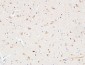 AAT Polyclonal Antibody