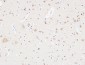 AAT Polyclonal Antibody