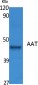 AAT Polyclonal Antibody