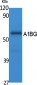 A1BG Polyclonal Antibody