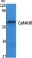 CaMKIIδ Polyclonal Antibody