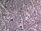 UBE4A Polyclonal Antibody