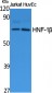 HNF-1β Polyclonal Antibody