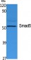 Smad5 Polyclonal Antibody