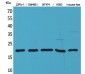 VEGF-A Polyclonal Antibody
