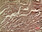 VEGF-A Polyclonal Antibody