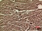 VEGF-A Polyclonal Antibody