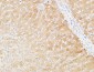 Prothrombin Polyclonal Antibody