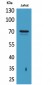 Prothrombin Polyclonal Antibody