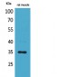 CA IV Polyclonal Antibody