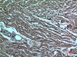 DR3 Polyclonal Antibody