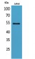 MMP-12 Polyclonal Antibody