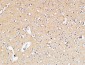 IL-10 Polyclonal Antibody