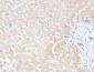 UCH-L1 Polyclonal Antibody