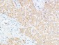 UCH-L1 Polyclonal Antibody